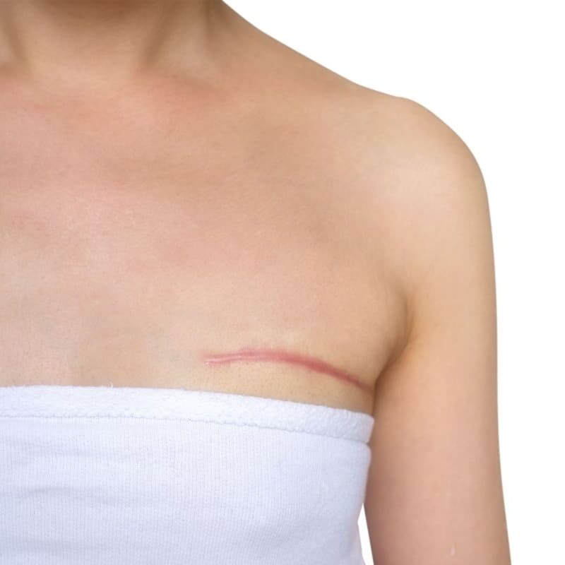 Chirurgie plastică reconstructivă