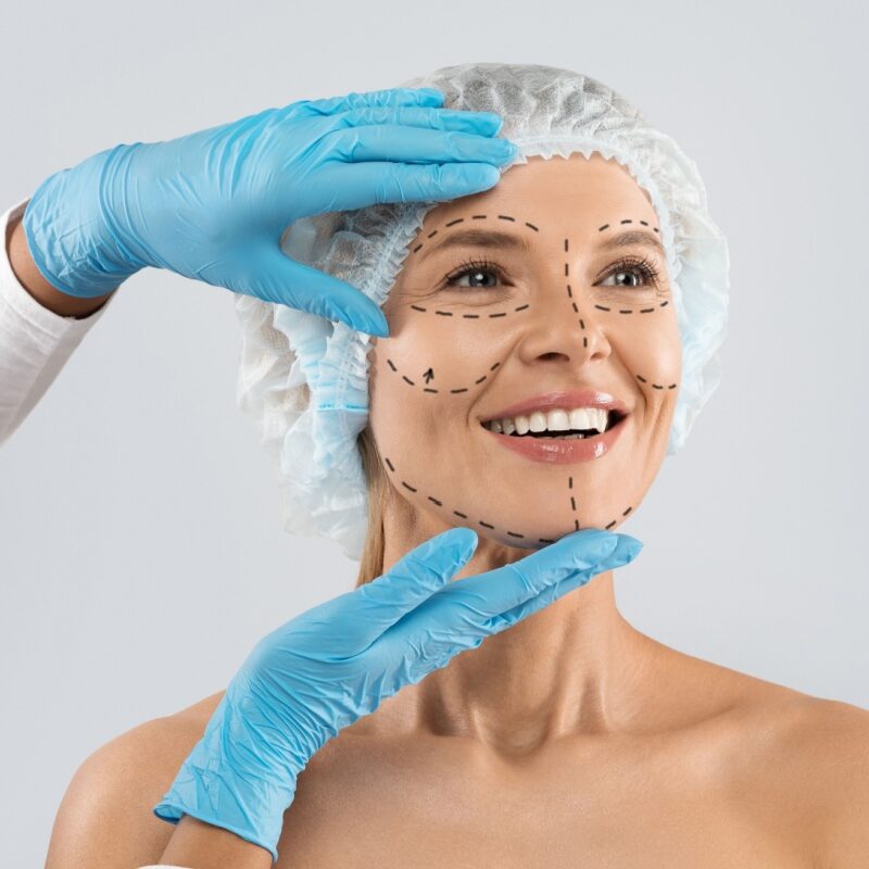 Lifting facial