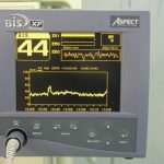 Monitor BIS pentru controlul profunzimii anesteziei și activității cerebrale în timpul intervențiilor chirurgicale la Estetis Clinic